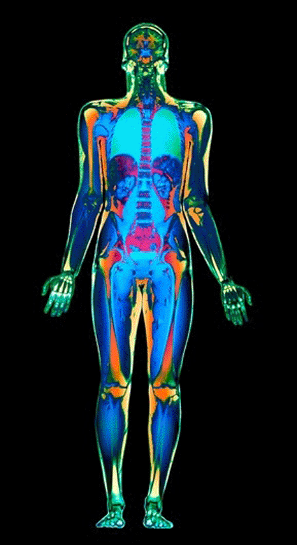 Image: Colored magnetic resonance imaging (MRI) scan of the whole body of a man in coronal (frontal) section (Photo courtesy of Simon Fraser / SPL).